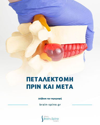POLYTHODORAKIS IOANNIS M.D. - ATHENS BRAIN & SPINE SURGERY: Φωτογραφίες & Βίντεο