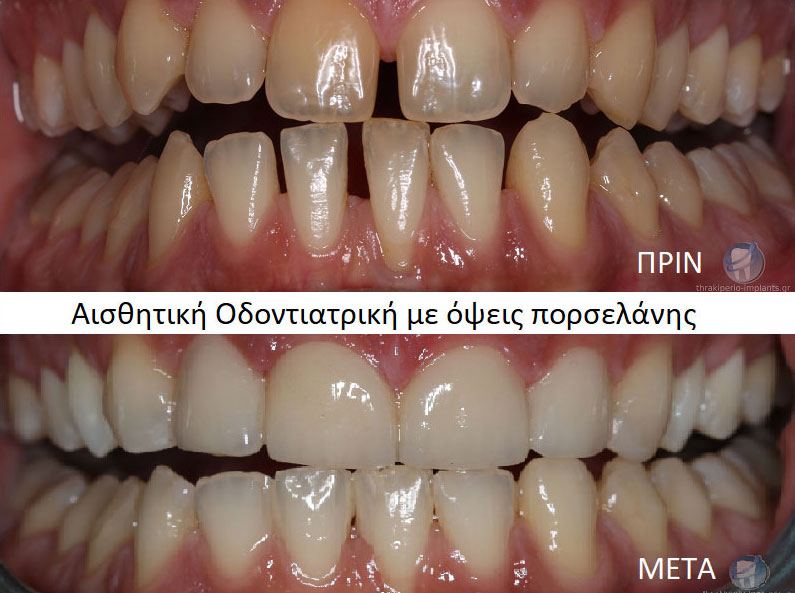 ΡΙΖΟΥ ΕΛΕΝΗ - ΣΥΜΕΩΝΙΔΗΣ ΙΩΑΝΝΗΣ: Φωτογραφίες & Βίντεο