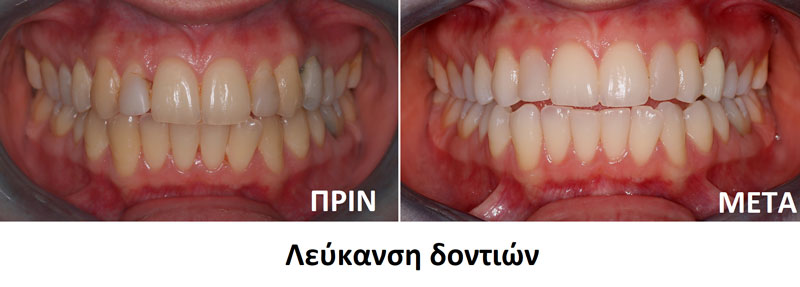 ΡΙΖΟΥ ΕΛΕΝΗ - ΣΥΜΕΩΝΙΔΗΣ ΙΩΑΝΝΗΣ: Φωτογραφίες & Βίντεο