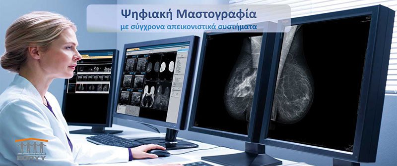 Ψηφιακή Μαστογραφία