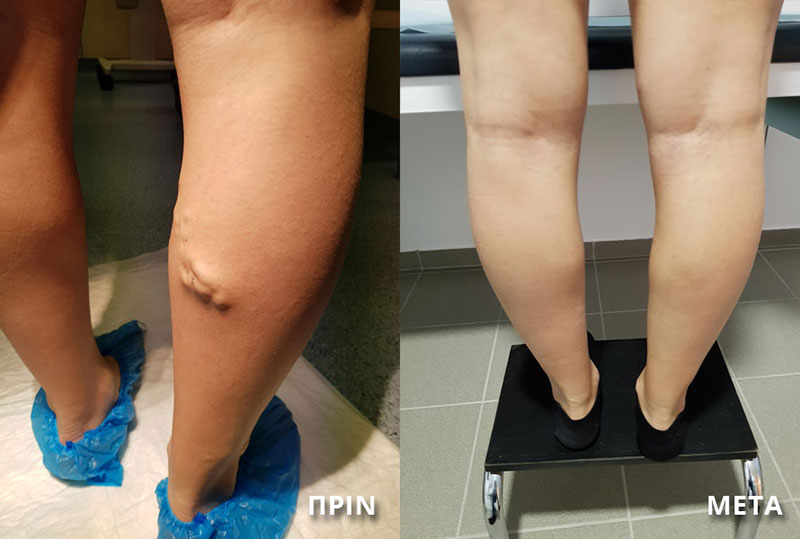ΣΑΛΙΒΕΡΟΣ ΑΠΟΣΤΟΛΟΣ: Φωτογραφίες & Βίντεο