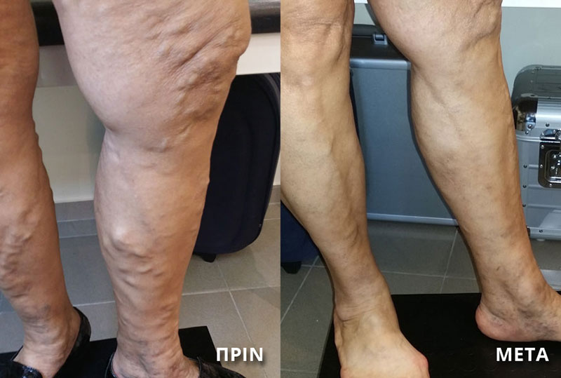 ΣΑΛΙΒΕΡΟΣ ΑΠΟΣΤΟΛΟΣ: Φωτογραφίες & Βίντεο