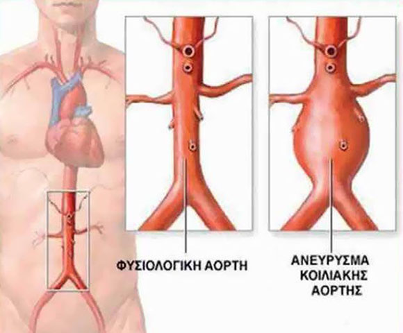 ΣΑΛΙΒΕΡΟΣ ΑΠΟΣΤΟΛΟΣ: Φωτογραφίες & Βίντεο
