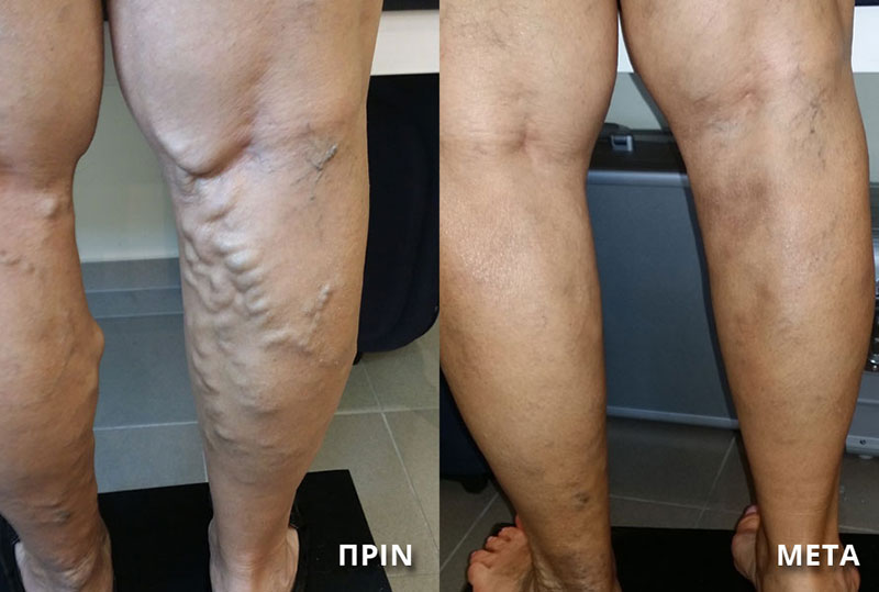 ΣΑΛΙΒΕΡΟΣ ΑΠΟΣΤΟΛΟΣ: Φωτογραφίες & Βίντεο