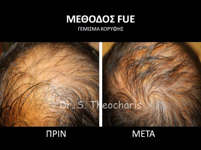 SKIN AND HAIR MEDICAL CARE - THEOCHARIS SOTIRIS: Φωτογραφίες & Βίντεο