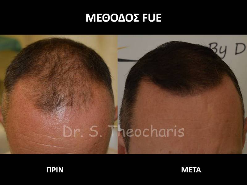 SKIN AND HAIR MEDICAL CARE - THEOCHARIS SOTIRIS: Φωτογραφίες & Βίντεο