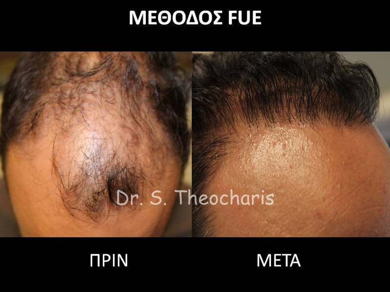 SKIN AND HAIR MEDICAL CARE - THEOCHARIS SOTIRIS: Φωτογραφίες & Βίντεο