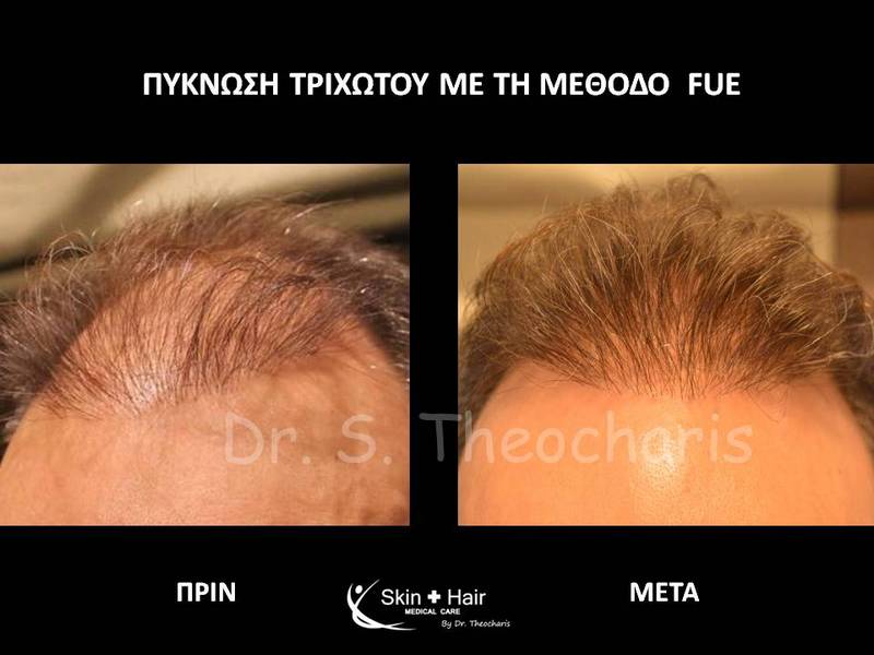 SKIN AND HAIR MEDICAL CARE - THEOCHARIS SOTIRIS: Φωτογραφίες & Βίντεο