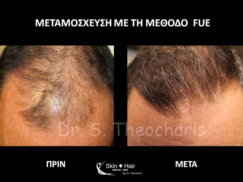 SKIN AND HAIR MEDICAL CARE - THEOCHARIS SOTIRIS: Φωτογραφίες & Βίντεο