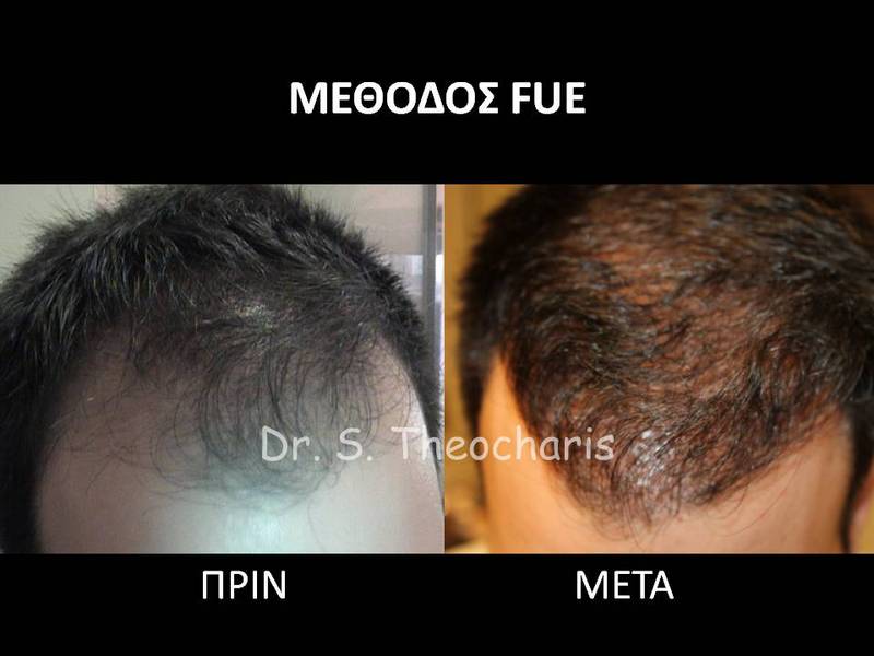 SKIN AND HAIR MEDICAL CARE - THEOCHARIS SOTIRIS: Φωτογραφίες & Βίντεο