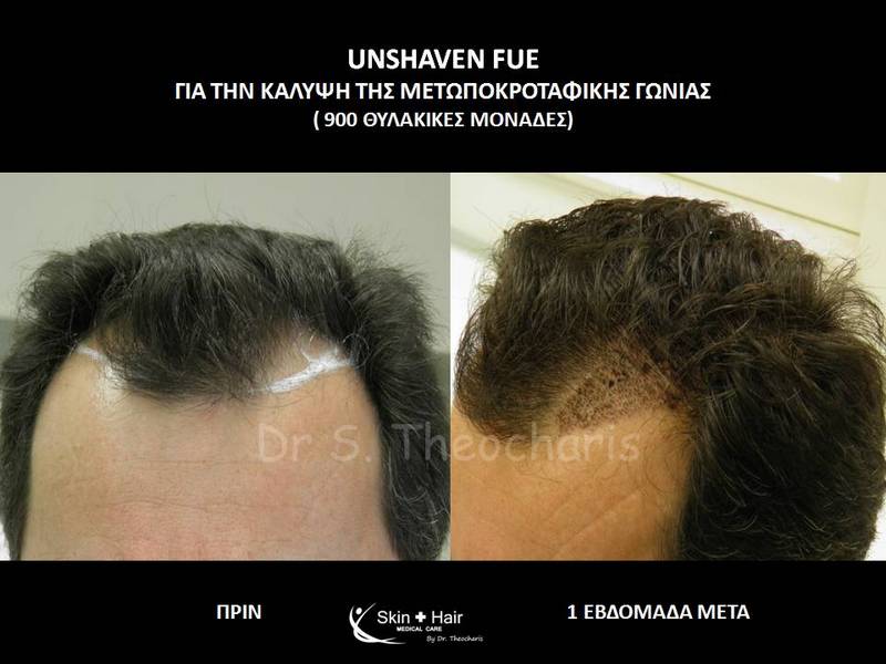 SKIN AND HAIR MEDICAL CARE - THEOCHARIS SOTIRIS: Φωτογραφίες & Βίντεο
