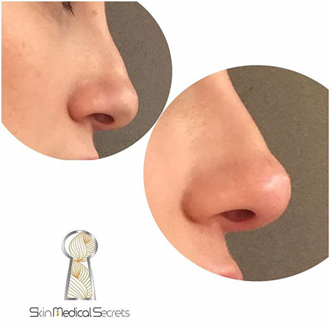 SKIN MEDICAL SECRETS DERMATOLOGY & PLASTIC SURGERY - ALMPANOPOULOU AGNI: Φωτογραφίες & Βίντεο