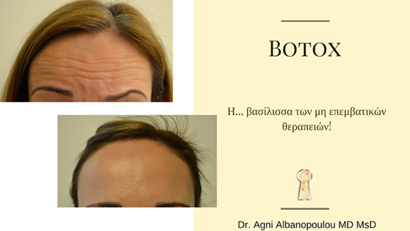 SKIN MEDICAL SECRETS DERMATOLOGY & PLASTIC SURGERY - ALMPANOPOULOU AGNI: Φωτογραφίες & Βίντεο