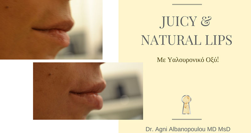 SKIN MEDICAL SECRETS DERMATOLOGY & PLASTIC SURGERY - ALMPANOPOULOU AGNI: Φωτογραφίες & Βίντεο