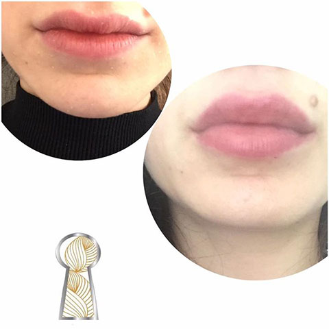 SKIN MEDICAL SECRETS DERMATOLOGY & PLASTIC SURGERY - ALMPANOPOULOU AGNI: Φωτογραφίες & Βίντεο