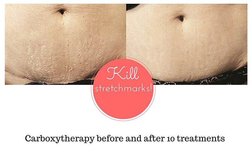 SKIN MEDICAL SECRETS DERMATOLOGY & PLASTIC SURGERY - ALMPANOPOULOU AGNI: Φωτογραφίες & Βίντεο