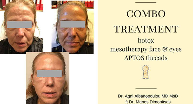 SKIN MEDICAL SECRETS DERMATOLOGY & PLASTIC SURGERY - ALMPANOPOULOU AGNI: Φωτογραφίες & Βίντεο