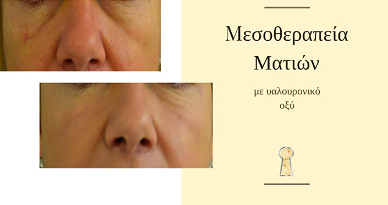 SKIN MEDICAL SECRETS DERMATOLOGY & PLASTIC SURGERY - ALMPANOPOULOU AGNI: Φωτογραφίες & Βίντεο