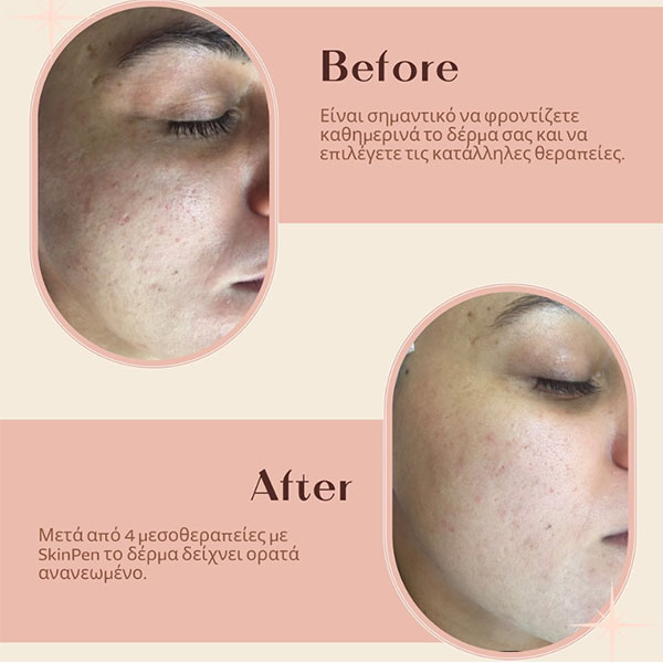 SKIN & MORE: Φωτογραφίες & Βίντεο
