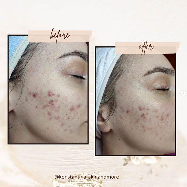 SKIN & MORE: Φωτογραφίες & Βίντεο