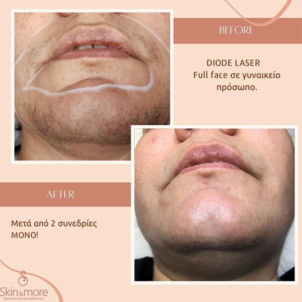 SKIN & MORE: Φωτογραφίες & Βίντεο