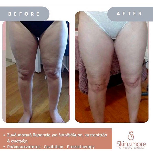 SKIN & MORE: Φωτογραφίες & Βίντεο
