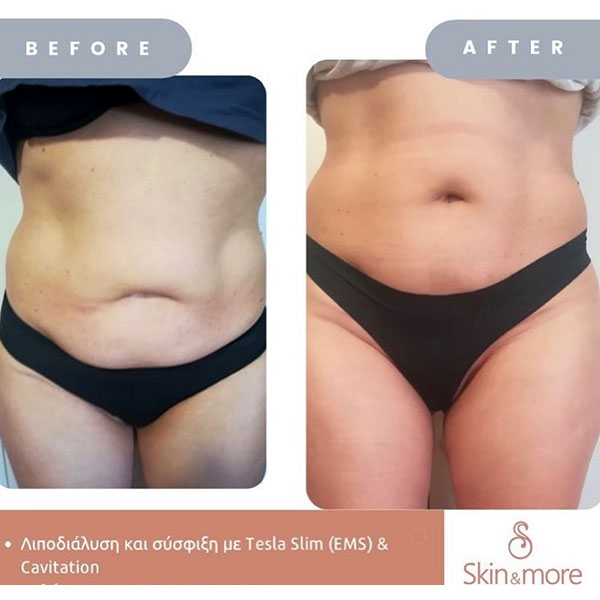 SKIN & MORE: Φωτογραφίες & Βίντεο