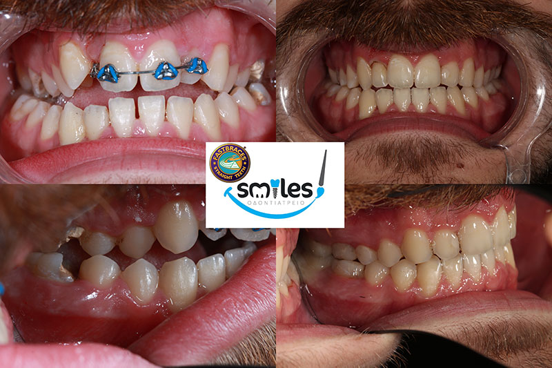 SMILES: Φωτογραφίες & Βίντεο