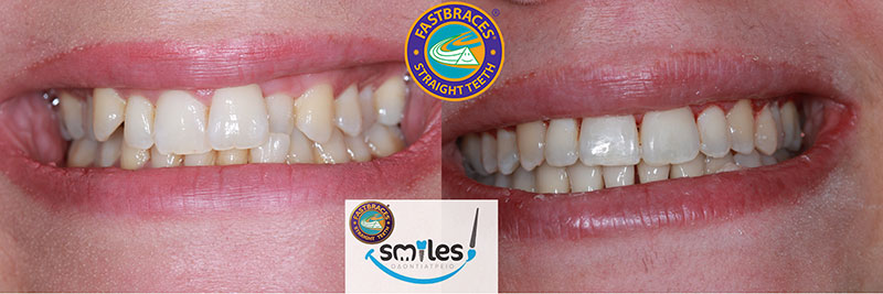 SMILES: Φωτογραφίες & Βίντεο