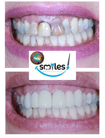 SMILES: Φωτογραφίες & Βίντεο