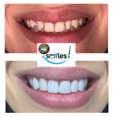 SMILES: Φωτογραφίες & Βίντεο