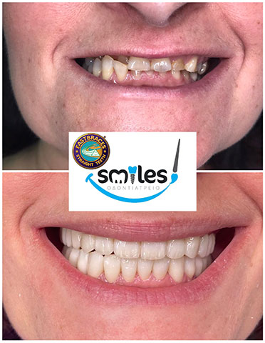 SMILES: Φωτογραφίες & Βίντεο