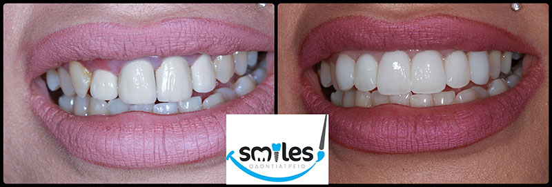 SMILES: Φωτογραφίες & Βίντεο