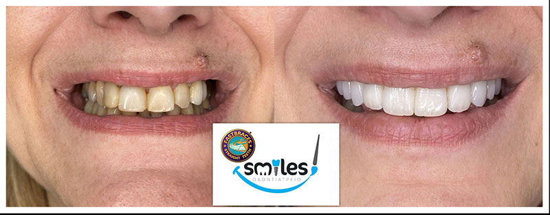 SMILES: Φωτογραφίες & Βίντεο