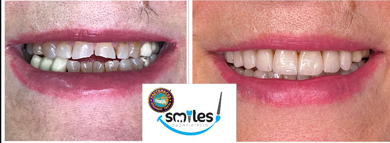 SMILES: Φωτογραφίες & Βίντεο
