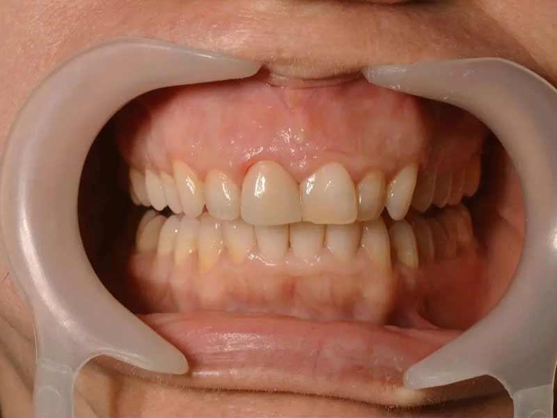 SMILE ART - VLASIOS N. SPURIDON: Φωτογραφίες & Βίντεο