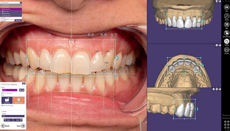 SMILE ART - VLASIOS N. SPURIDON: Φωτογραφίες & Βίντεο