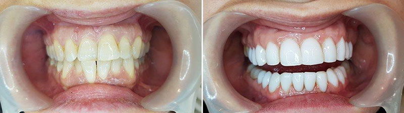 SOUTH ATHENS DENTAL CLINIC - ΔΕΣΠΟΤΑΚΗΣ Ι. ΕΜΜΑΝΟΥΗΛ: Φωτογραφίες & Βίντεο