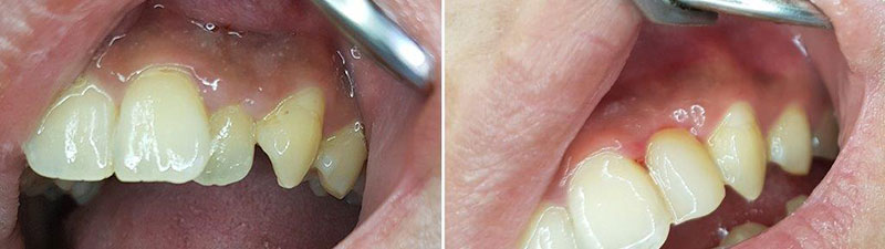 SOUTH ATHENS DENTAL CLINIC - ΔΕΣΠΟΤΑΚΗΣ Ι. ΕΜΜΑΝΟΥΗΛ: Φωτογραφίες & Βίντεο