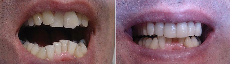 SOUTH ATHENS DENTAL CLINIC - ΔΕΣΠΟΤΑΚΗΣ Ι. ΕΜΜΑΝΟΥΗΛ: Φωτογραφίες & Βίντεο