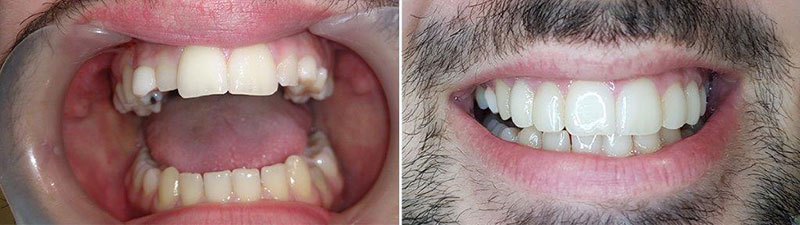SOUTH ATHENS DENTAL CLINIC - ΔΕΣΠΟΤΑΚΗΣ Ι. ΕΜΜΑΝΟΥΗΛ: Φωτογραφίες & Βίντεο