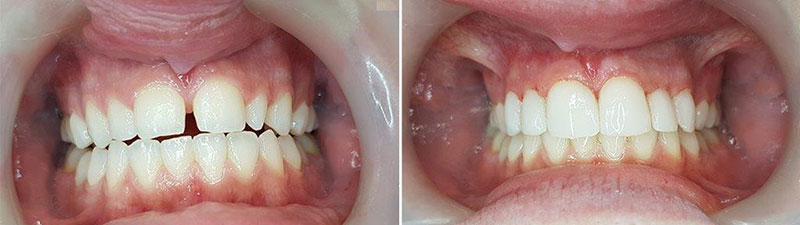 SOUTH ATHENS DENTAL CLINIC - ΔΕΣΠΟΤΑΚΗΣ Ι. ΕΜΜΑΝΟΥΗΛ: Φωτογραφίες & Βίντεο