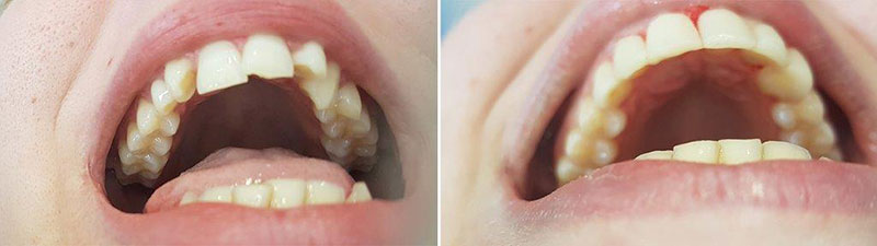 SOUTH ATHENS DENTAL CLINIC - ΔΕΣΠΟΤΑΚΗΣ Ι. ΕΜΜΑΝΟΥΗΛ: Φωτογραφίες & Βίντεο