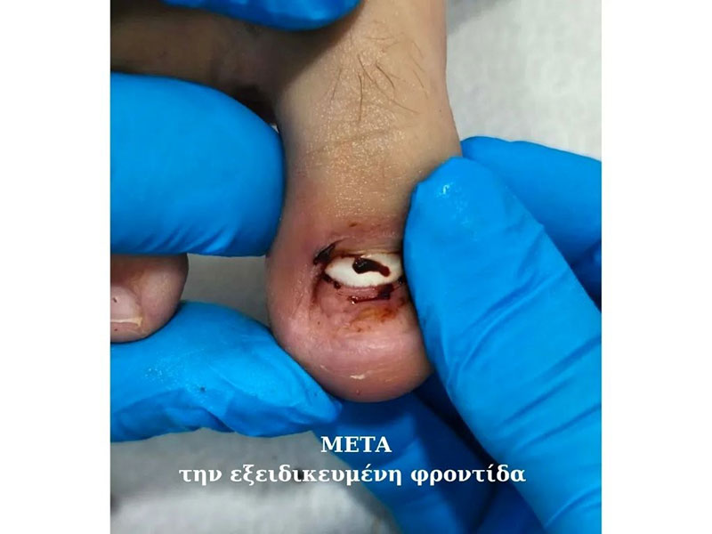 ΕΙΔΙΚΟ ΚΕΝΤΡΟ ΠΟΔΟΛΟΓΙΑΣ ΒΟΥΛΑΓΚΑ ΡΑΝΙΑ: Φωτογραφίες & Βίντεο