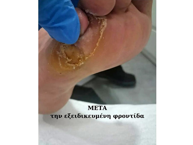 ΕΙΔΙΚΟ ΚΕΝΤΡΟ ΠΟΔΟΛΟΓΙΑΣ ΒΟΥΛΑΓΚΑ ΡΑΝΙΑ: Φωτογραφίες & Βίντεο