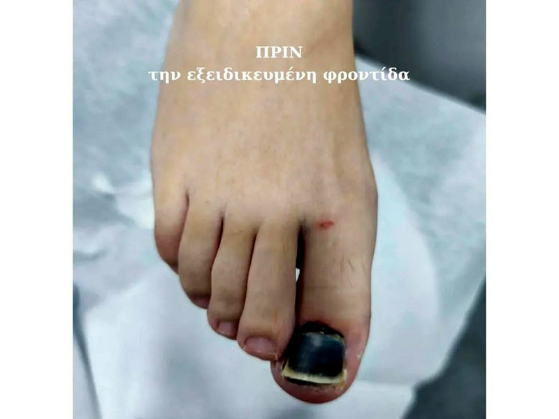 ΕΙΔΙΚΟ ΚΕΝΤΡΟ ΠΟΔΟΛΟΓΙΑΣ ΒΟΥΛΑΓΚΑ ΡΑΝΙΑ: Φωτογραφίες & Βίντεο