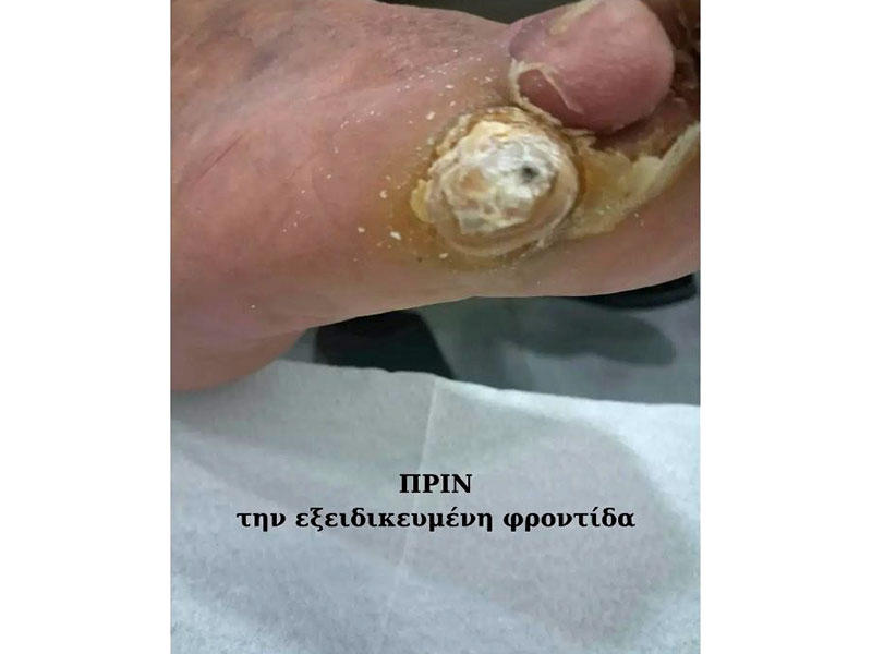 ΕΙΔΙΚΟ ΚΕΝΤΡΟ ΠΟΔΟΛΟΓΙΑΣ ΒΟΥΛΑΓΚΑ ΡΑΝΙΑ: Φωτογραφίες & Βίντεο