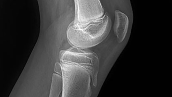SPORTS MEDICINE CENTER - MANOLOGLOU KONSTANTINOS Dr: Φωτογραφίες & Βίντεο
