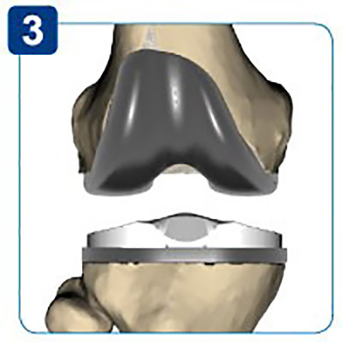 SPORTS MEDICINE CENTER - MANOLOGLOU KONSTANTINOS Dr: Φωτογραφίες & Βίντεο