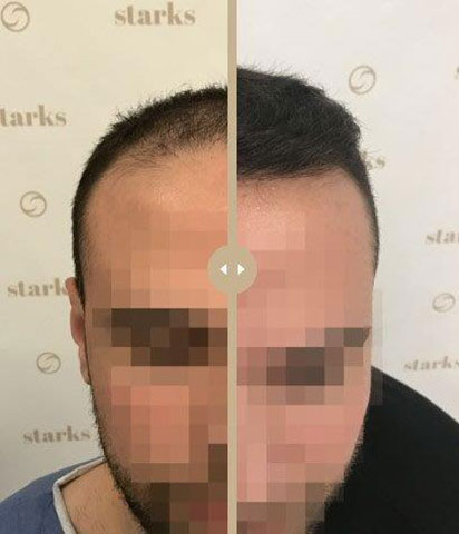 STARKS: Φωτογραφίες & Βίντεο
